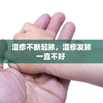 濕疹不斷起膿，濕疹發(fā)膿一直不好 