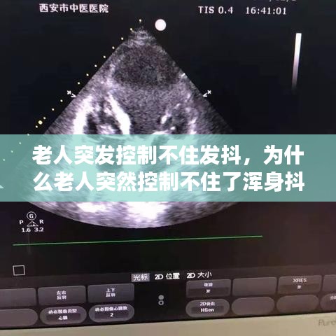 老人突發(fā)控制不住發(fā)抖，為什么老人突然控制不住了渾身抖動 