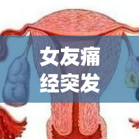 女友痛經(jīng)突發(fā)如何應(yīng)對？超實用指南助你輕松應(yīng)對！