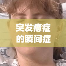 突發(fā)癔癥的瞬間癥狀表現(xiàn)，識別與應(yīng)對的關(guān)鍵時刻