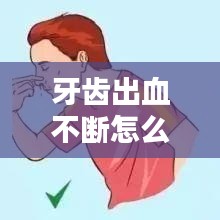 牙齒出血不斷怎么弄好，牙齒出血不停怎么止血 