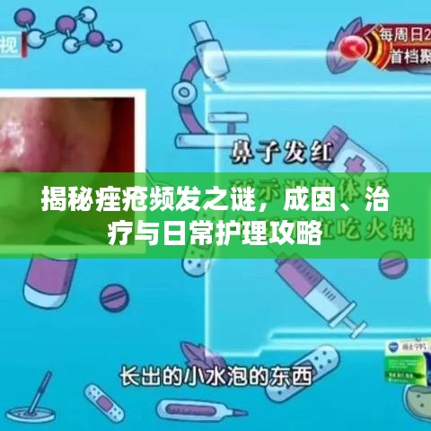 揭秘痤瘡頻發(fā)之謎，成因、治療與日常護(hù)理攻略