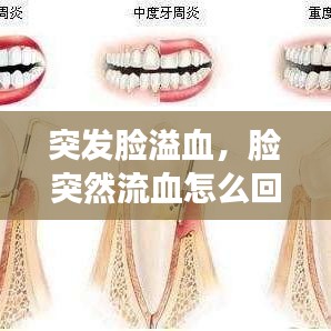 突發(fā)臉溢血，臉突然流血怎么回事 
