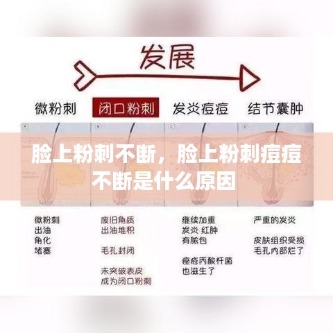 臉上粉刺不斷，臉上粉刺痘痘不斷是什么原因 