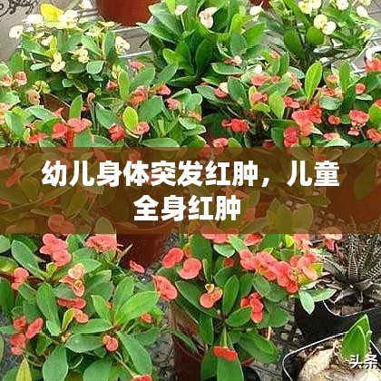 幼兒身體突發(fā)紅腫，兒童全身紅腫 