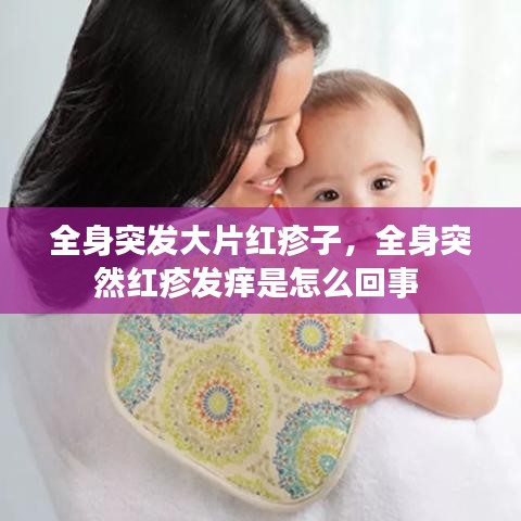 全身突發(fā)大片紅疹子，全身突然紅疹發(fā)癢是怎么回事 