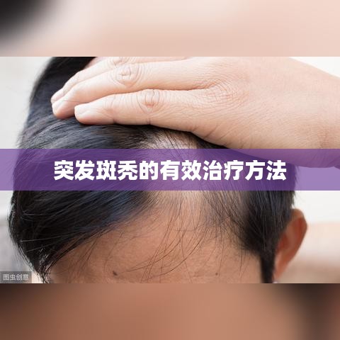 突發(fā)斑禿的有效治療方法