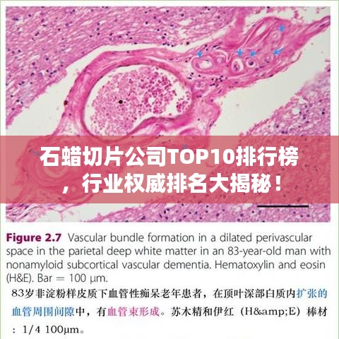 石蠟切片公司TOP10排行榜，行業(yè)權(quán)威排名大揭秘！