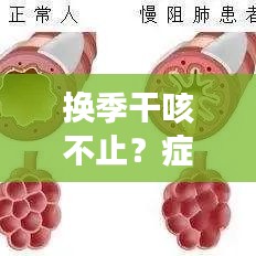 換季干咳不止？癥狀解析與應(yīng)對(duì)方案全攻略