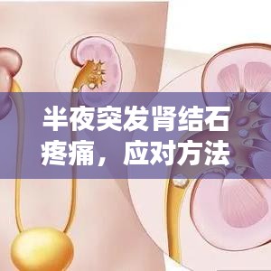半夜突發(fā)腎結石疼痛，應對方法、預防策略全解析